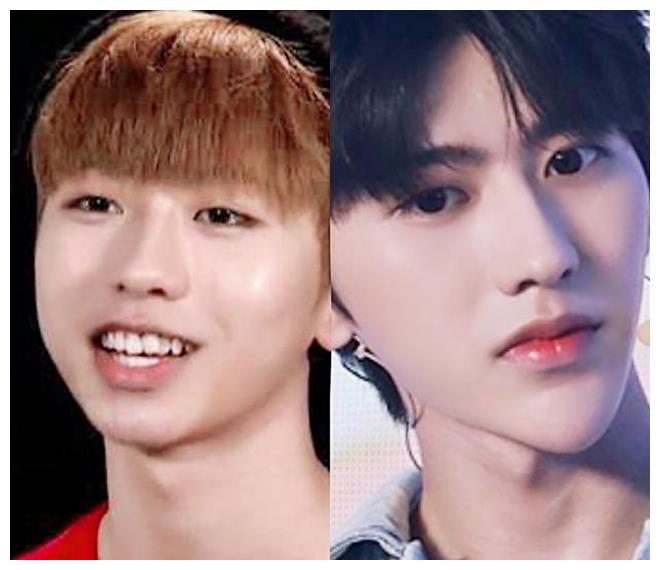 奔跑吧:蔡徐坤吹气球下巴"变形",前后对比太明显,整容实锤?