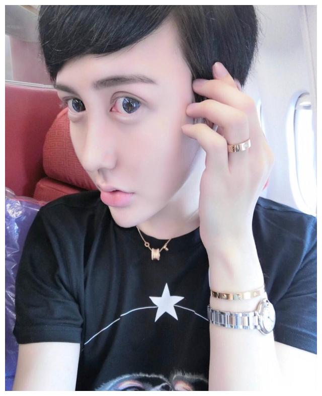 蛇精男刘梓晨近照流出,迷恋整容千百回,再次整容终成清新男孩