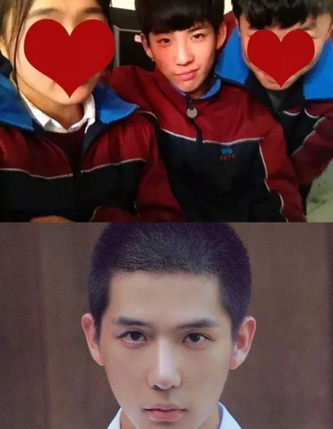 王安宇现身整形医院粉丝解释皮肤管理网友劝他整牙