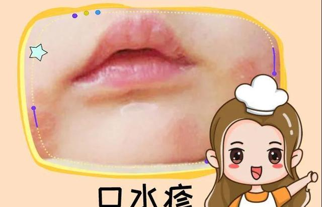 分清疹子夏季不做斑点宝宝看这篇就够了附图解