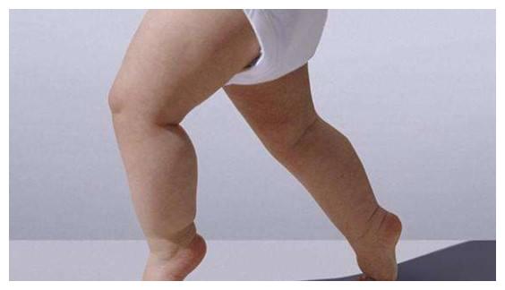 穿纸尿裤的宝宝腿不直?这三件事才是罪魁祸首!