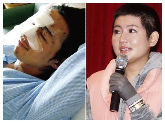 当红男星片场受伤,眼睛血流不止!腿软跪地上直问:我不会瞎了吧