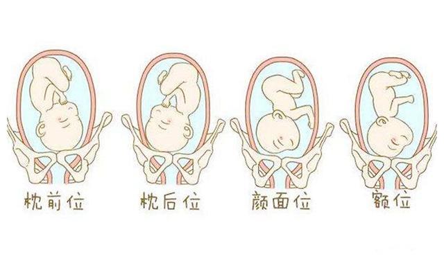 臀位,横位,斜位各种高风险胎位都可能出现,而且到了孕36~37周,再想