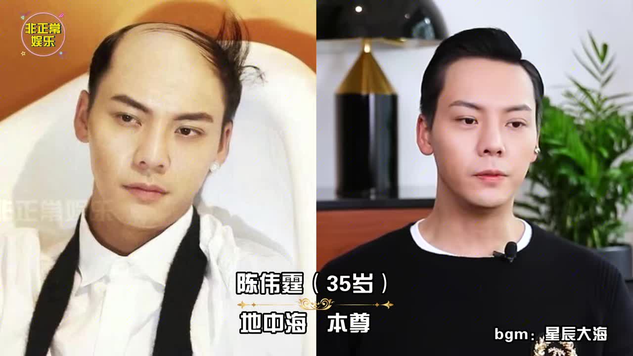 当男星变成"地中海"发型,鹿晗变身谢广坤,只有第9位完美驾驭