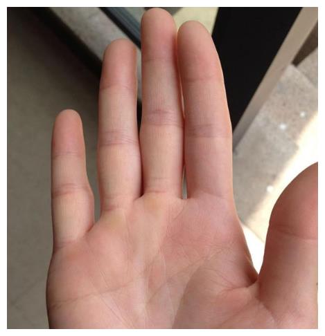 女人大指头出现这几种状况必定财富满满一生富贵无忧