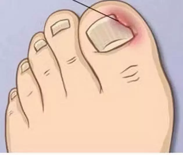 张长弓seo优化信息流广告