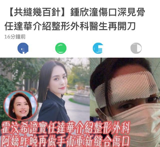 阿娇伤势严重深可见骨 为防毁容缝几百针 任达华介绍整形科医生 阿娇伤势严重深可见骨 为防毁容缝几百针 任达华介绍整形科医生