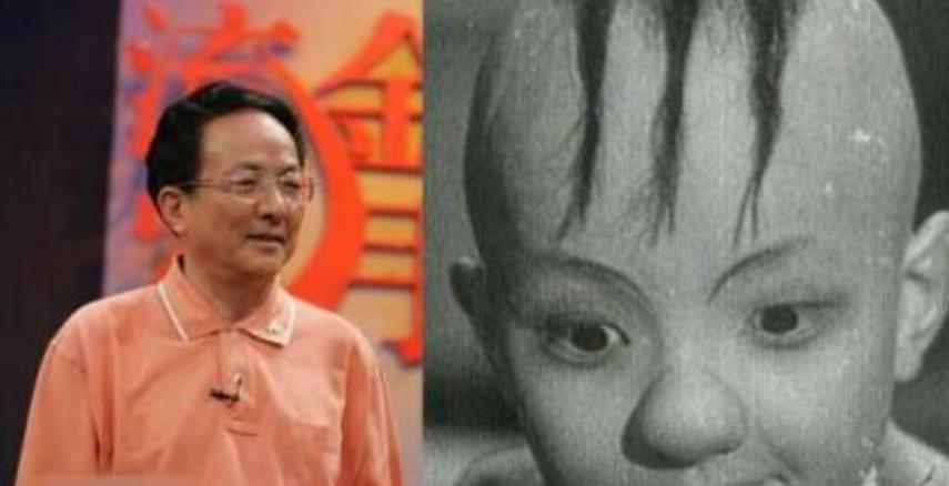 "三毛"长大了!曾因头皮受伤息影多年,至今单身:不红不谈恋爱