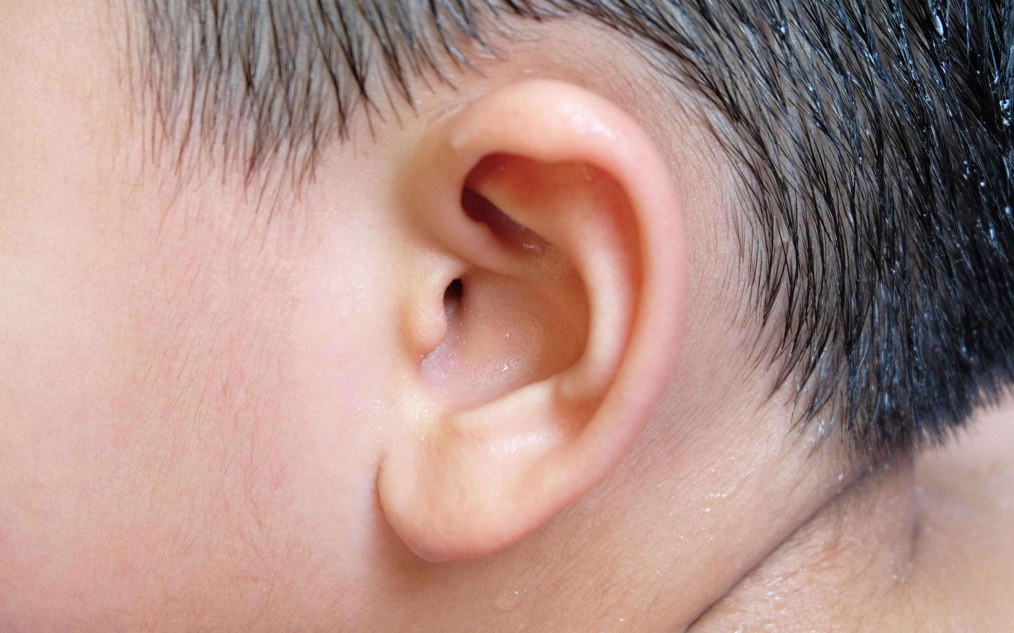 劉承信醫師丨 耳鼻喉頭頸專科｜顏面整型重建專科 ｜美好的外型 更佳的呼吸: 耳屎多耳朵癢要怎麼清耳屎？耳朵醫師建議你這樣挖耳朵耳屎耳垢