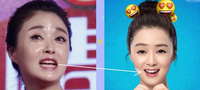 如何让牙齿变白（如何让牙齿变白最简单的方法）-85模板网