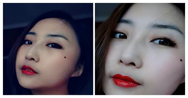 女人右脸腮边有痣图解