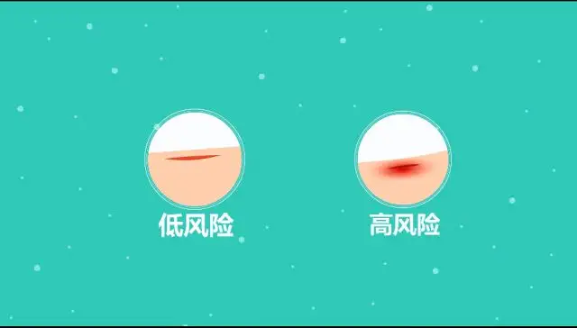 什么情况下容易患破伤风?医生是这么说的休闲区蓝鸢梦想 - Www.slyday.coM 什么情况下容易患破伤风?医生是这么说的休闲区蓝鸢梦想 - Www.slyday.coM