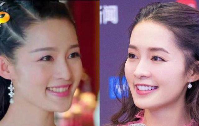 如何让牙齿变白（如何让牙齿变白最简单的方法）-85模板网