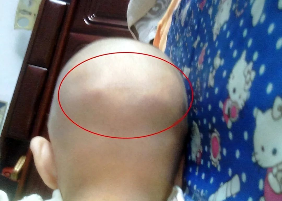 孩子聪不聪明看头型就知道，这种说法靠谱吗？你别傻傻地被忽悠了休闲区蓝鸢梦想 - Www.slyday.coM