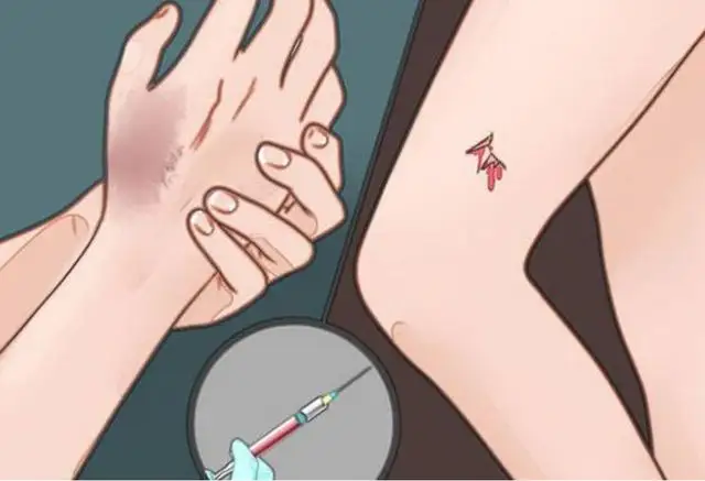 什么情况下容易患破伤风?医生是这么说的休闲区蓝鸢梦想 - Www.slyday.coM 什么情况下容易患破伤风?医生是这么说的休闲区蓝鸢梦想 - Www.slyday.coM