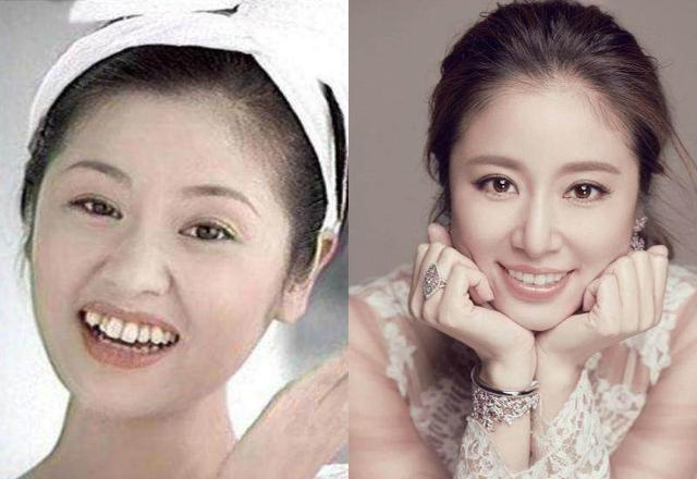 如何让牙齿变白（如何让牙齿变白最简单的方法）-85模板网