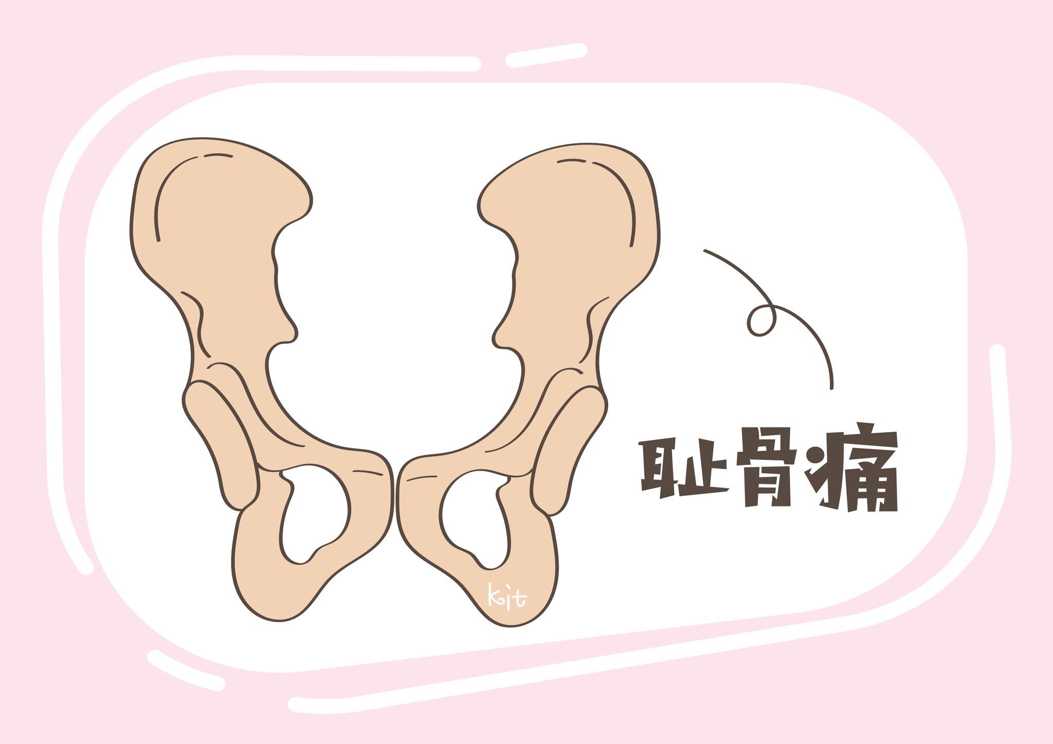 怀孕期间,这5类女性要注意,"耻骨痛"更容易"盯"上你