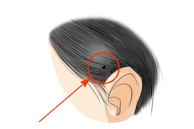 身上有这三颗大吉痣,最有福气,注定一生大富大贵,好运连连!