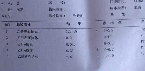 乙肝病毒主要指标:乙肝两对半和乙肝dna用于监测血清乙肝病毒的主要