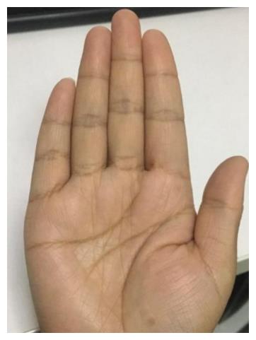 女性苦命的手特征贫病交加难享夫福没人疼爱孤苦无助