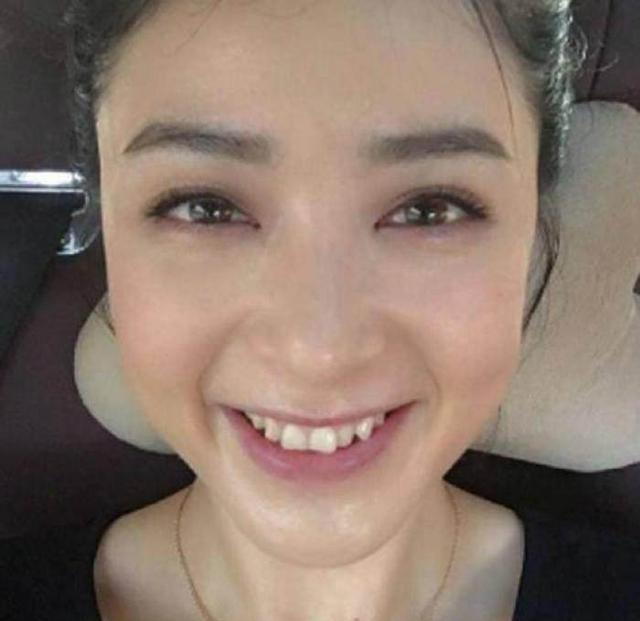 如何让牙齿变白（如何让牙齿变白最简单的方法）-85模板网