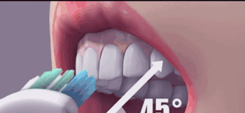 如何让牙齿变白（如何让牙齿变白最简单的方法）-85模板网