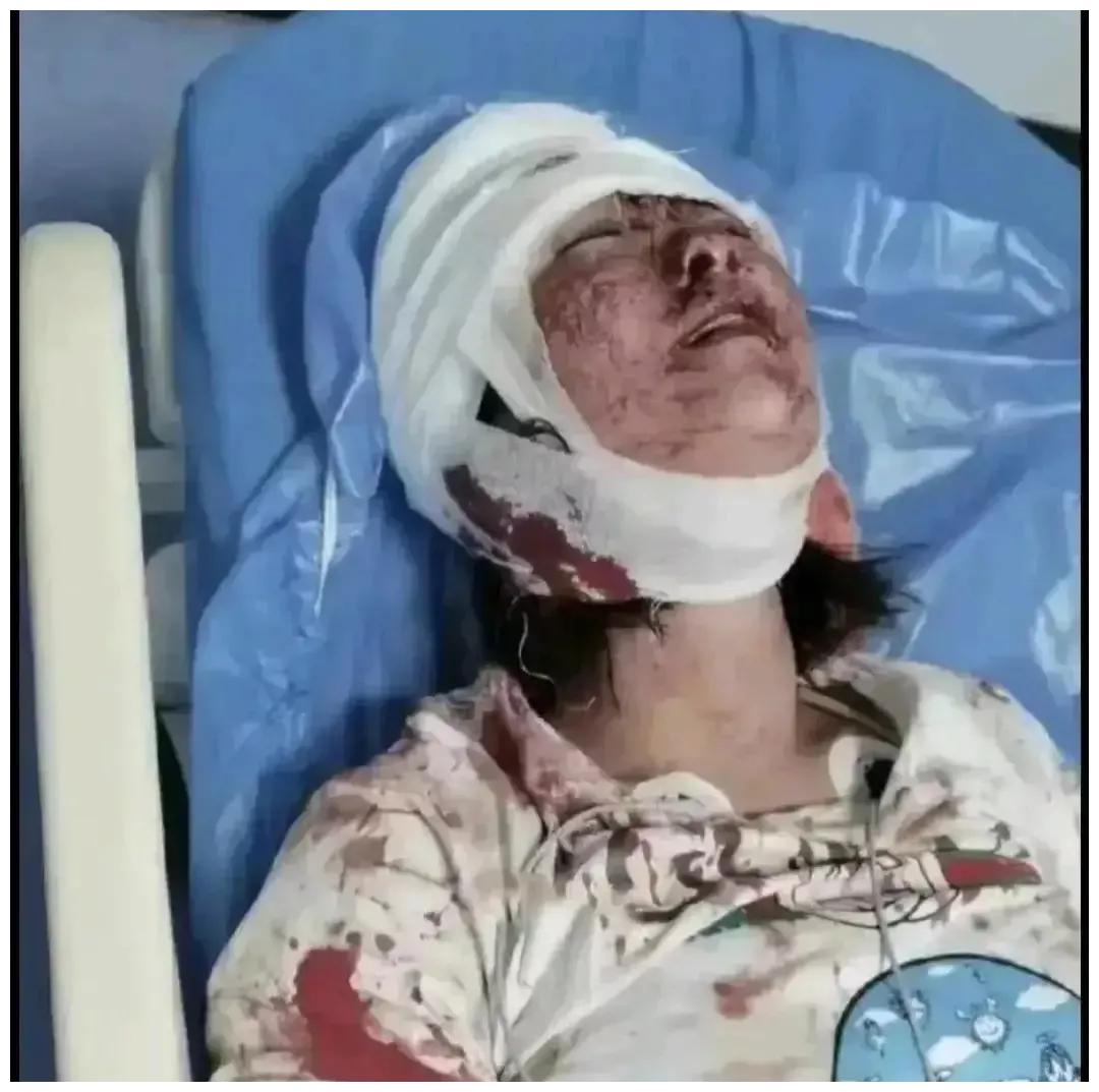 唐山打人案件,涉案人员需要赔偿多少钱?看到金额后悔了休闲区蓝鸢梦想 - Www.slyday.coM 唐山打人案件,涉案人员需要赔偿多少钱?看到金额后悔了休闲区蓝鸢梦想 - Www.slyday.coM