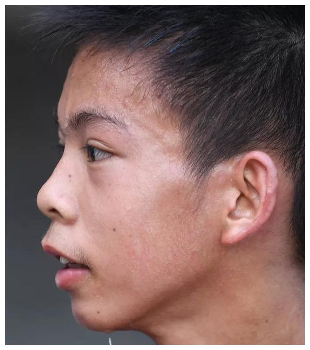 独臂男孩火爆海外篮球圈,看看外国网友怎么评价他