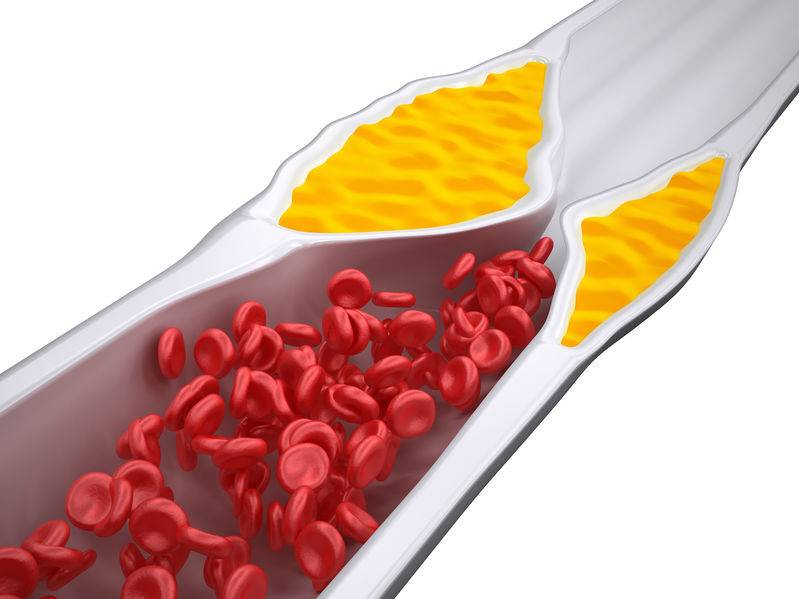 心脏支架到底是什么?它对寿命有何影响?医生给的分析,不妨看看休闲区蓝鸢梦想 - Www.slyday.coM 心脏支架到底是什么?它对寿命有何影响?医生给的分析,不妨看看休闲区蓝鸢梦想 - Www.slyday.coM