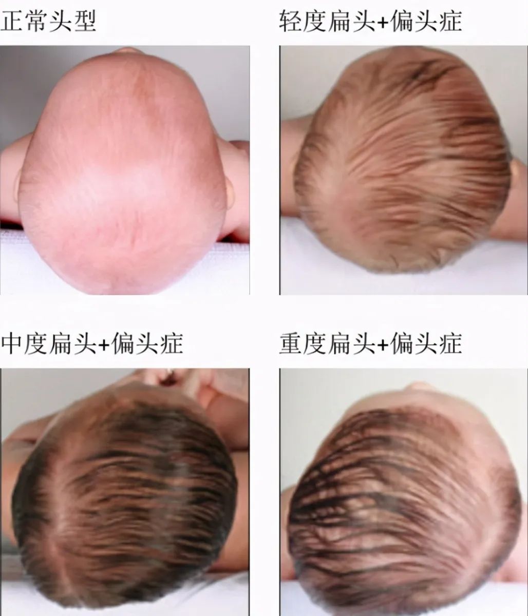 孩子聪不聪明看头型就知道，这种说法靠谱吗？你别傻傻地被忽悠了休闲区蓝鸢梦想 - Www.slyday.coM