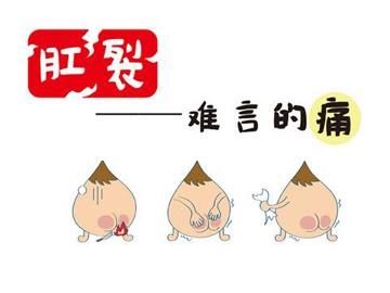 北京东大肛肠医院:女性为什么容易得肛裂呢?