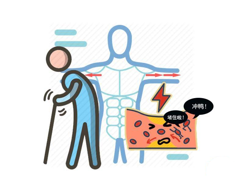 年过60的老人若想长寿，是运动好还是静养好？医生的建议不妨看看