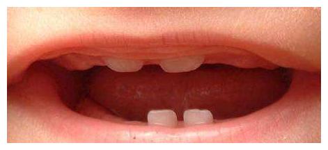 问:宝宝长牙的顺序与时间?|宝宝|牙龈|齿槽_新浪新闻