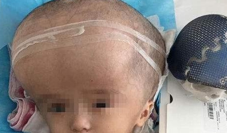 11年过去了,当年喝了"三鹿奶粉"的孩子 网友评论一针见血