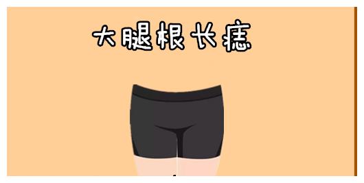 大腿根长痣在相学当中,若是一个人的大腿根的位置处长有吉痣,则属于