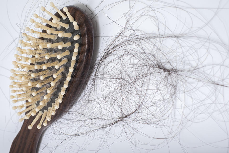 本人男，34岁掉头发很严重怎么办？脸头都很油，这段时间每天早上洗头都会掉好多，头顶都能看到头皮了