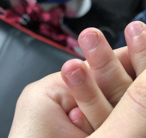 孩子从小"咬指甲",长大后会怎样?专家断言:逃不掉这2种结局