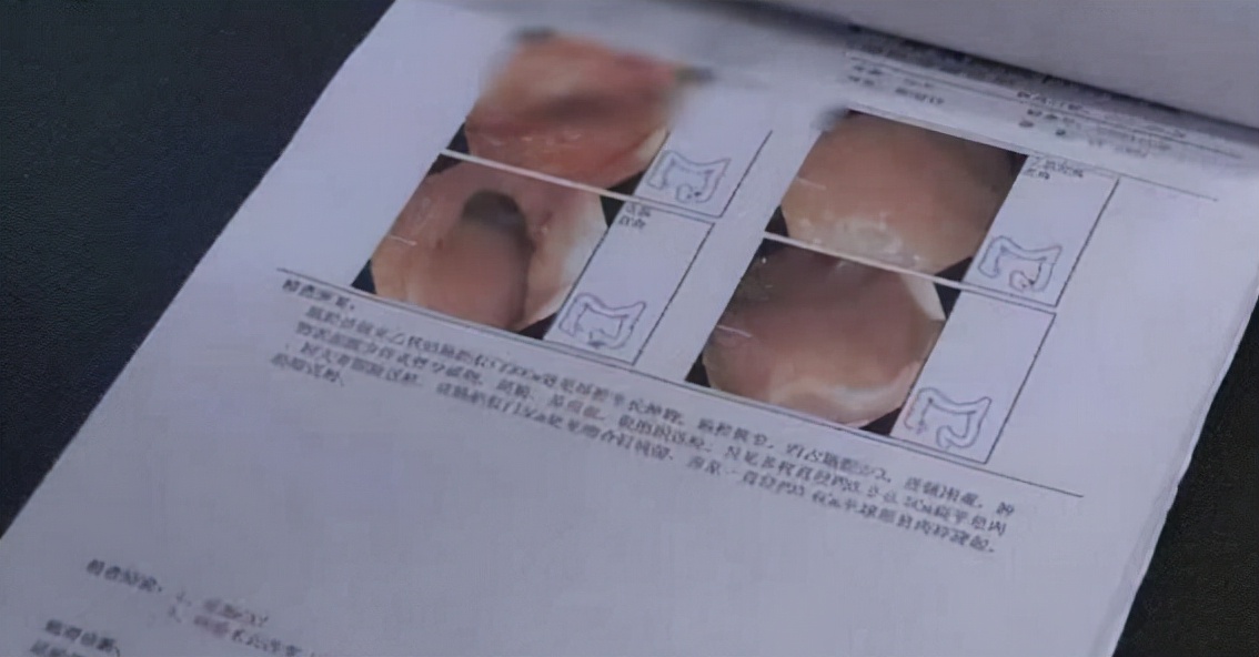 女子贫血1年多查出结肠癌？这个检查项目，有的癌症可以早发现休闲区蓝鸢梦想 - Www.slyday.coM