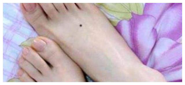 脚背有痣寓意经常需要外出或奔波中度日.