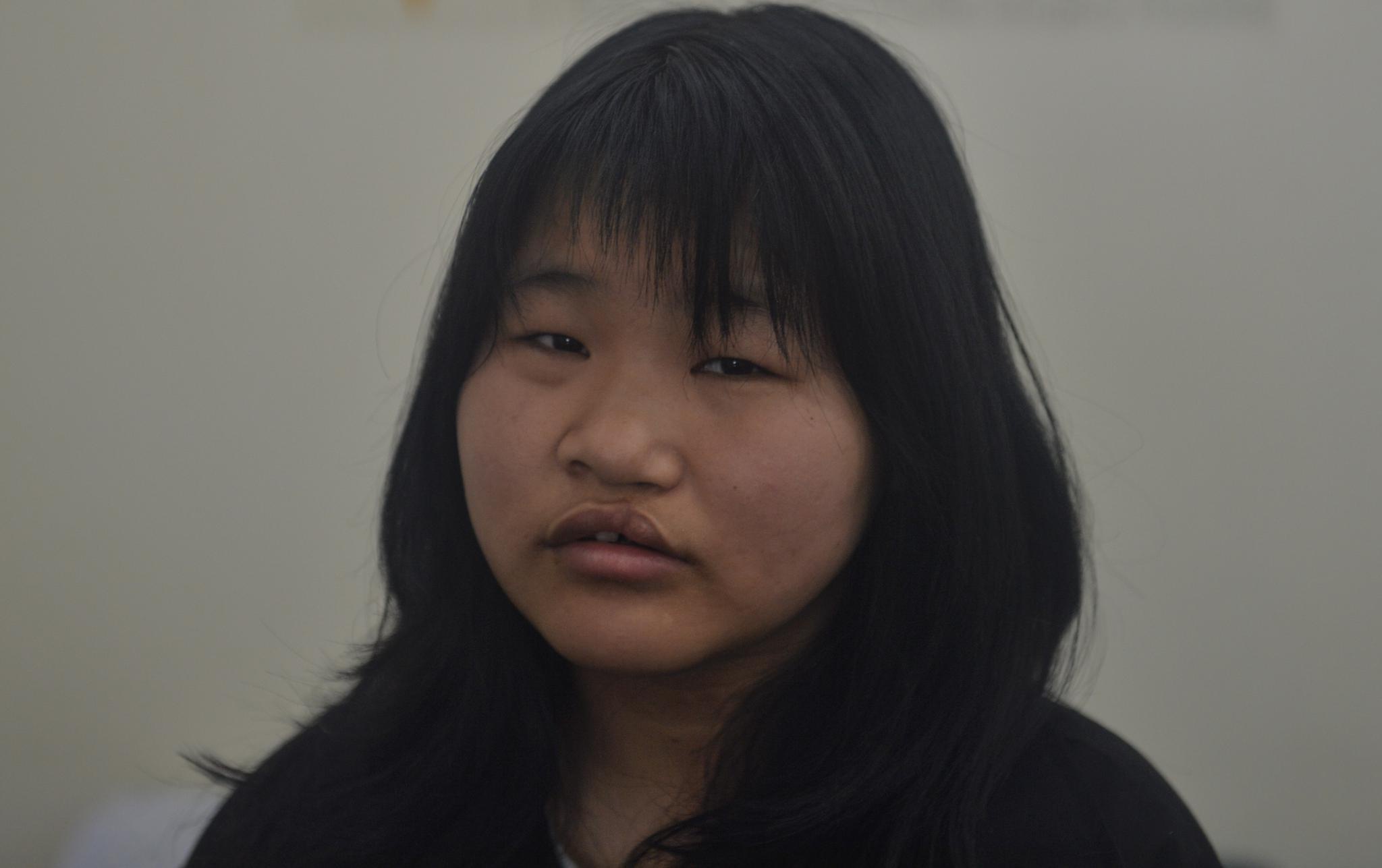 女孩因丑出生被抛弃 如今18岁"美"梦成真:用手术"改脸转运"