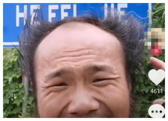 简直变成了一个地中海大叔.