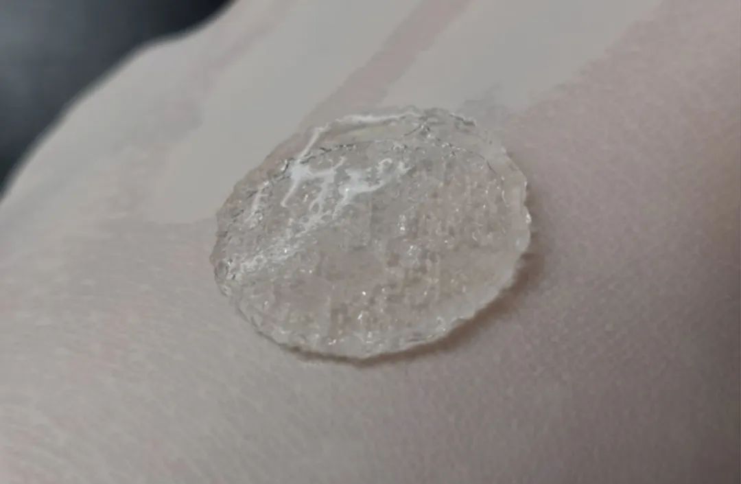 我国3D打印人造皮肤临床应用重要突破，伤口“一键”愈合