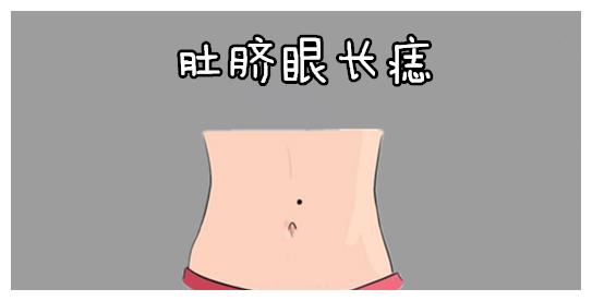 肚脐眼长痣在相学当中,若是孩子的肚脐眼的位置,出生就有吉痣,则天生