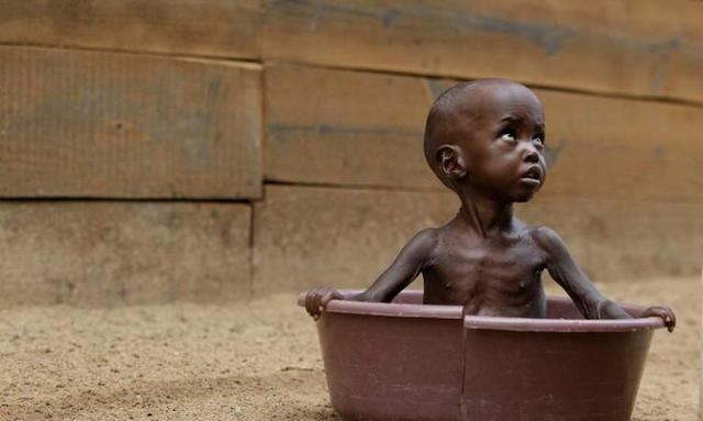 你是在度假还是在旅行?看着那些小孩满身都是苍蝇,你作何感想?