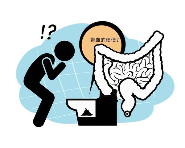 女子贫血1年多查出结肠癌？这个检查项目，有的癌症可以早发现休闲区蓝鸢梦想 - Www.slyday.coM