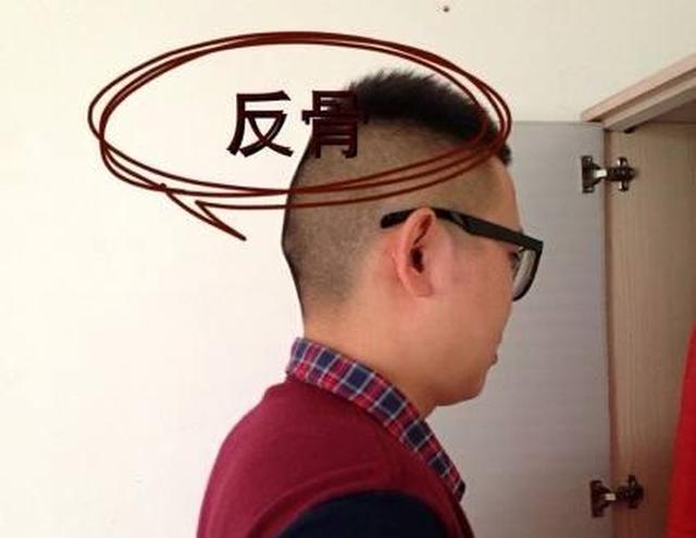 脑后有反骨好不好,这样的人多吗?|婴儿|枕骨|变异_新浪新闻