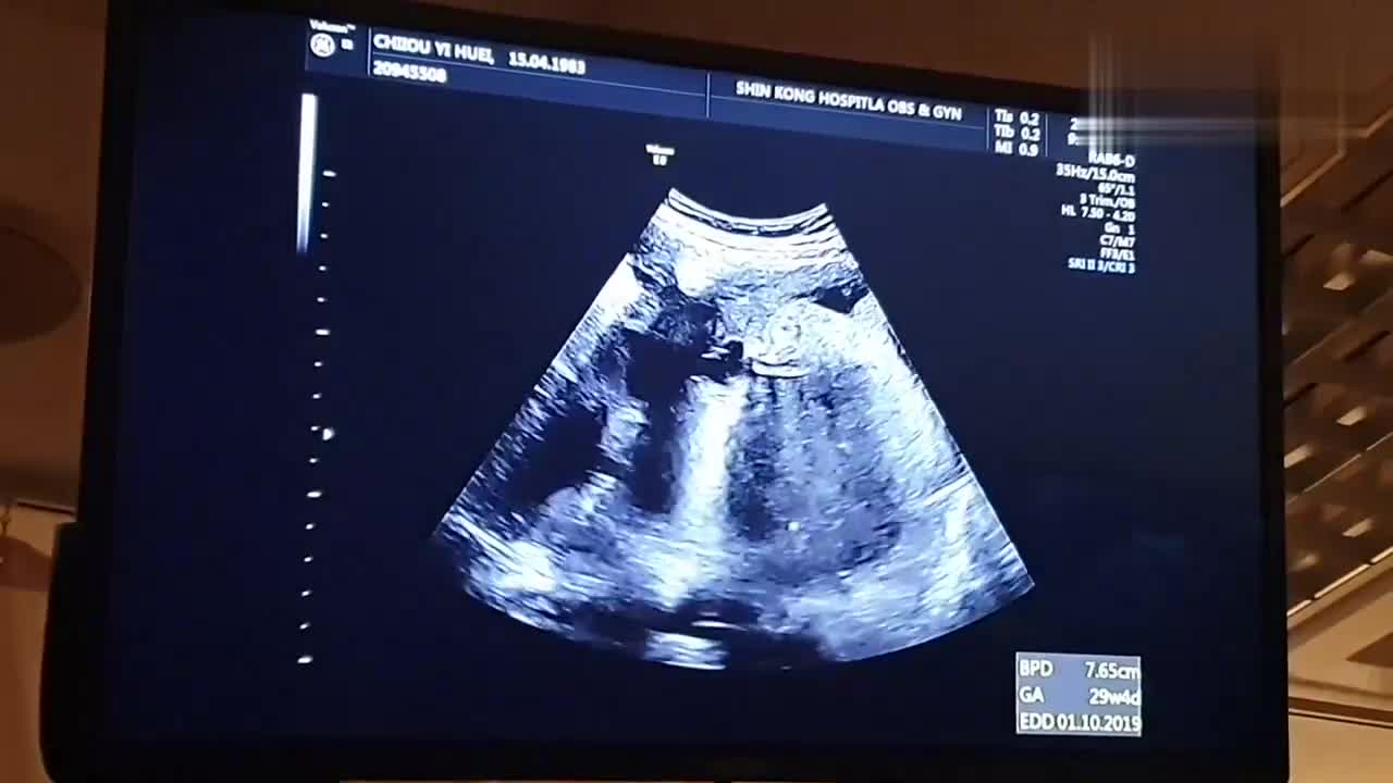 孕29周四维彩超产检过程实录,宝宝的手指脚趾都能看的很清楚!