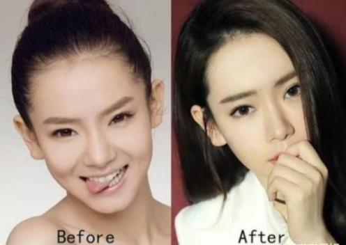 娱乐圈整容最成功的艺人明明动过无数次却一点也看不出来
