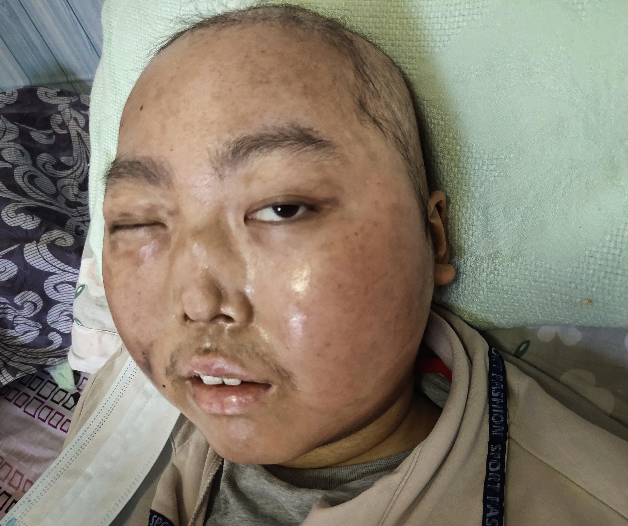 昔日富商一夜白头学霸儿子被切掉鼻子仍自信满满读书又不靠脸