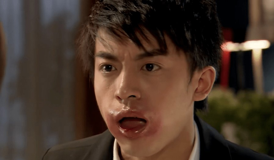 过敏的后果,不知道大家看过《爱情公寓》没,有一集大张伟就是因为吃了